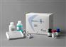 人抗心磷脂抗体IgM(ACA-IgM)ELisa检测试剂盒